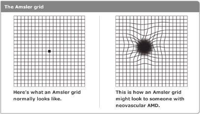 Amsler grid